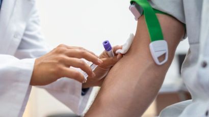 Secretaria de Saúde de Xanxerê investirá mais de R$ 2 milhões por ano em exames laboratoriais