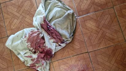Morador é agredido e tem veículo roubado em assalto no interior de Abelardo Luz