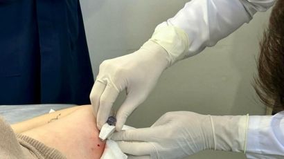 Xanxerê capacita médicos para a aplicação de novo método contraceptivo pelo SUS