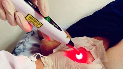 Prefeitura de Xanxerê implanta serviço de laserterapia através do programa Saúde no Lar
