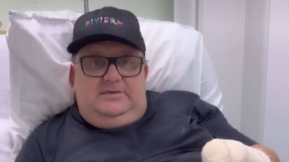 Humorista Pilha tem a mão amputada após acidente com fogos de artifício em Xaxim