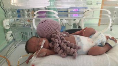 Prematuros da UTI Neonatal do HRSP ganham ensaio fotográfico e polvos de crochê