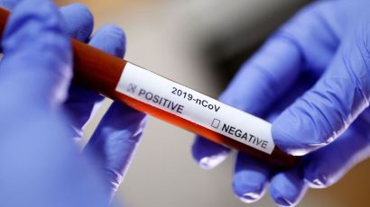 Casos de covid aumentam nesta época do ano, o que reforça importância de medidas preventivas